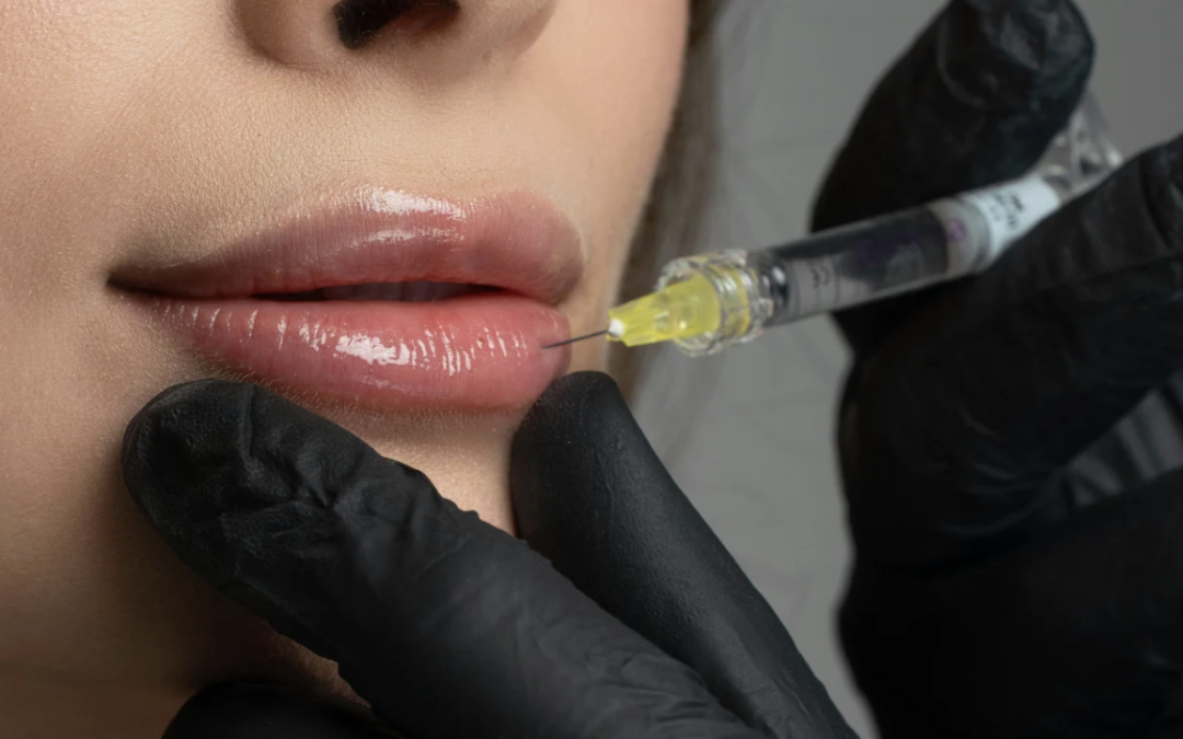 Lip Enhancement and Volume Restoration Consultation in Rockville, Maryland